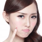 acne-free-program