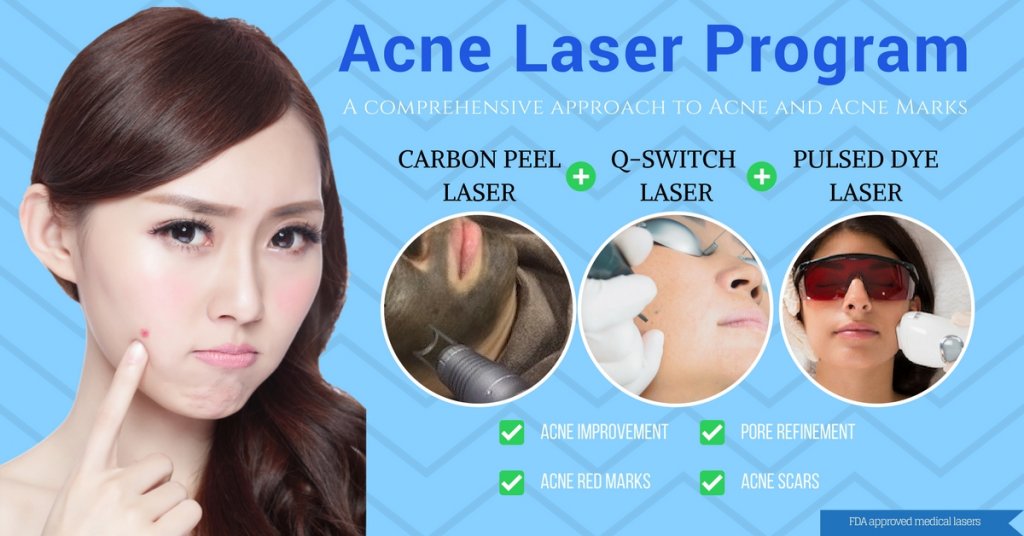 treat acne marks and scars with the acne laser program