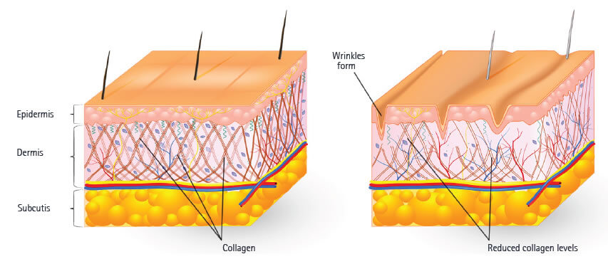collagen reduces with aging