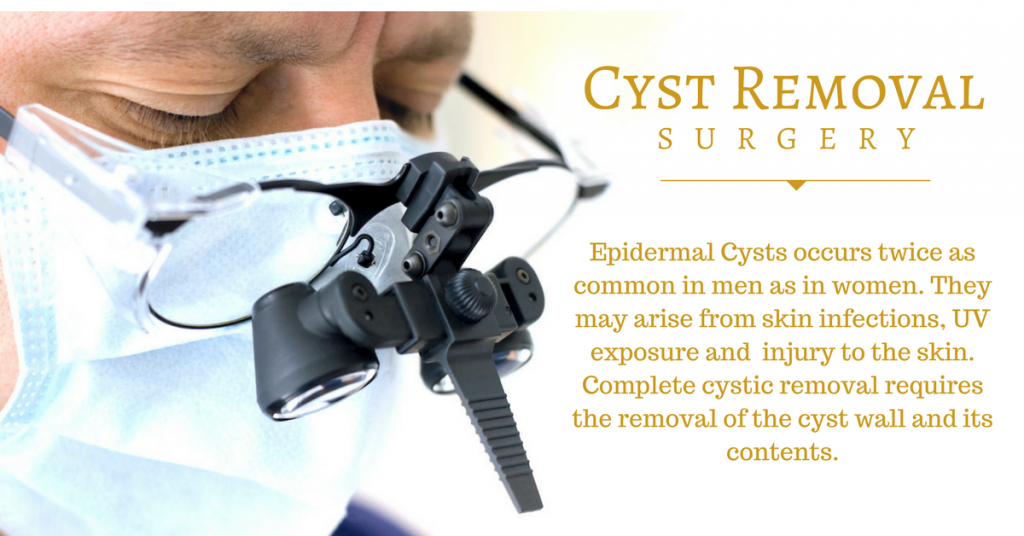 best epidermal cystic removal in singapore