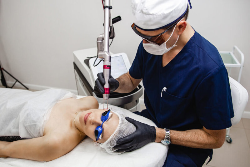 postinflammatory hyperpigmentation laser removal