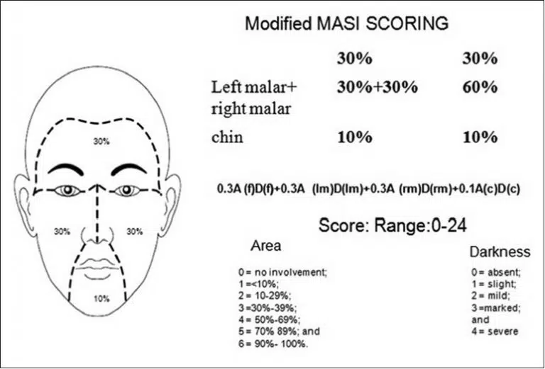 Melasma Area and Severity Index (MASI) Singapore