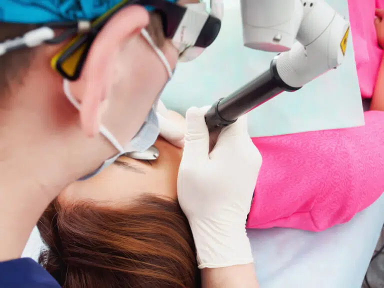 Laser Treatment for Melasma Singapore